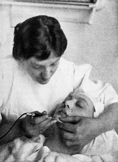 1914 Electrolysis treatment