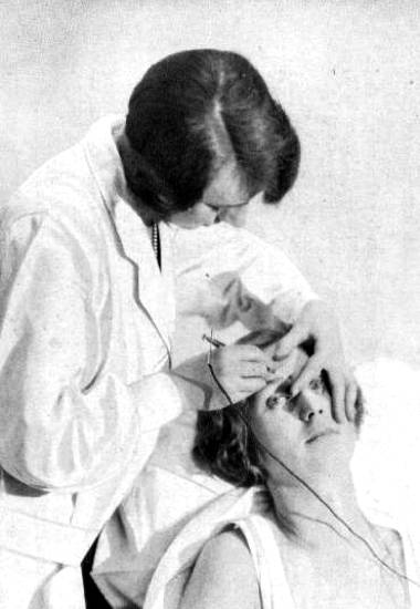 1924 Electrolysis procedure on eyebrow hair