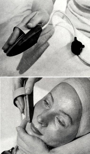 1939 Phebel Facial Iron