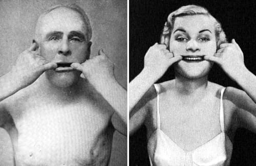 Exercises to correct a drooping mouth