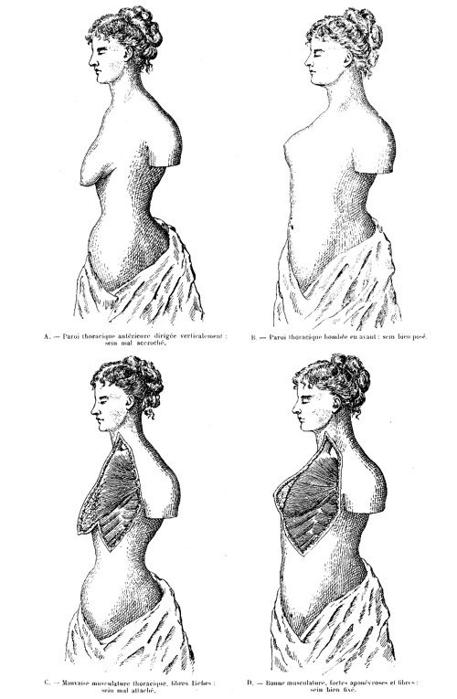 1908 Illustrations emphasing the importance of chest musculature