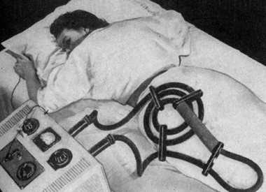 1954 Diathermy machine used to treat sciatica