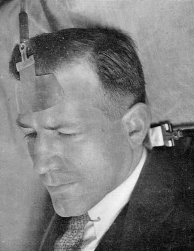 1930 A man having a diathermy heat treatment on his brain