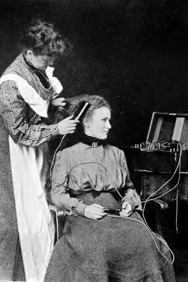 1903 Direct faradic treatment using the hairbrush electrode