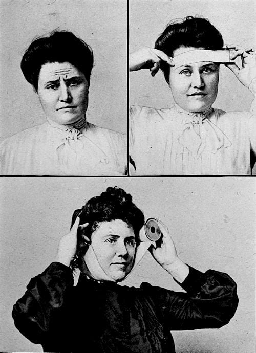 1905 Strapping the face with adhesive plaster